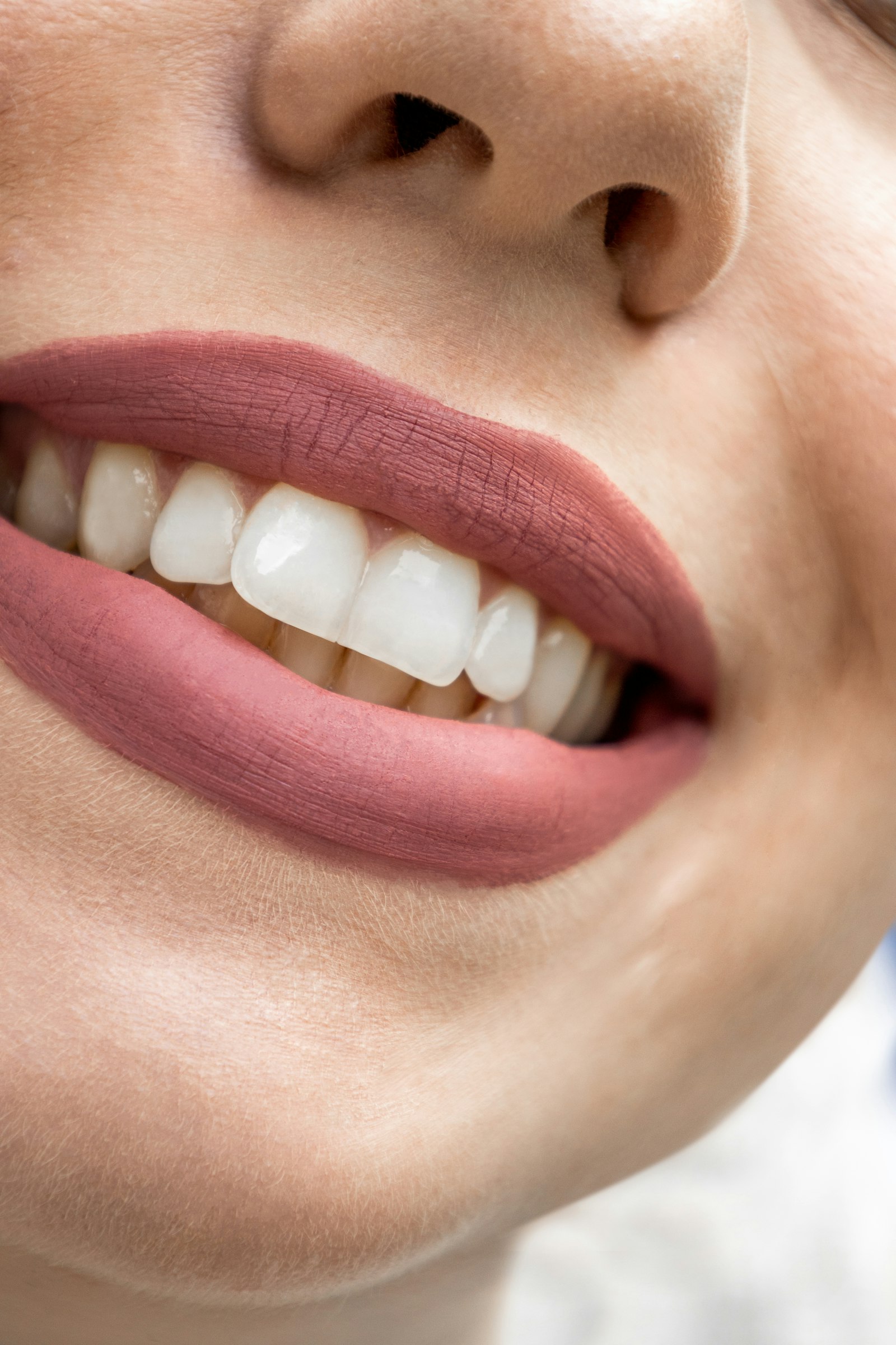 Carillas dentales FirstFit en Huelva